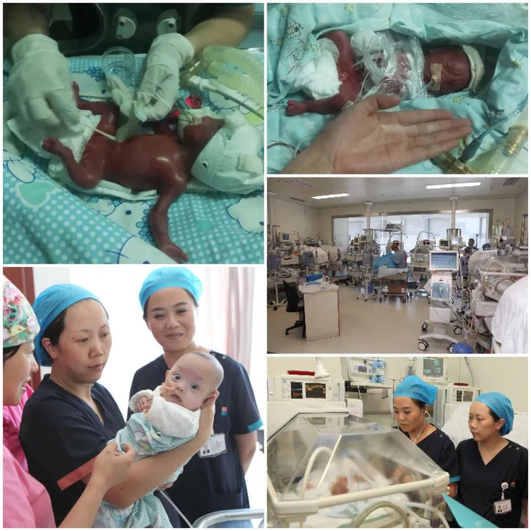 370g Premature Baby Survives in Lanzhou